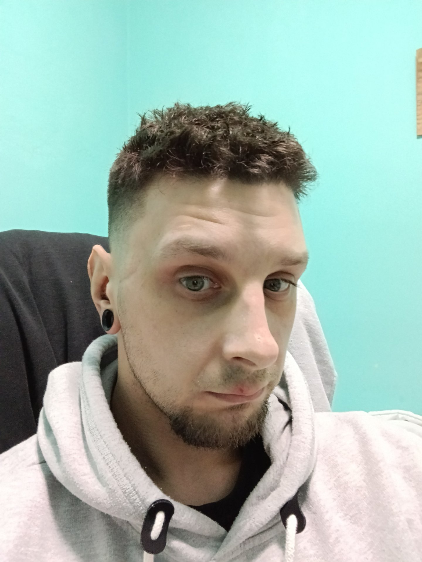 Foto 1