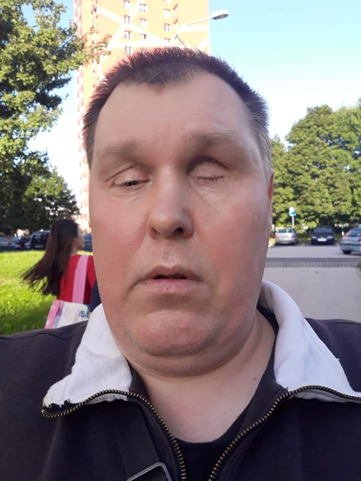 Foto 1